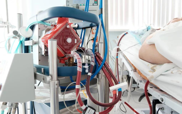 熱點(diǎn) | 填補(bǔ)國(guó)產(chǎn)空白，ECMO迎來“中國(guó)造”